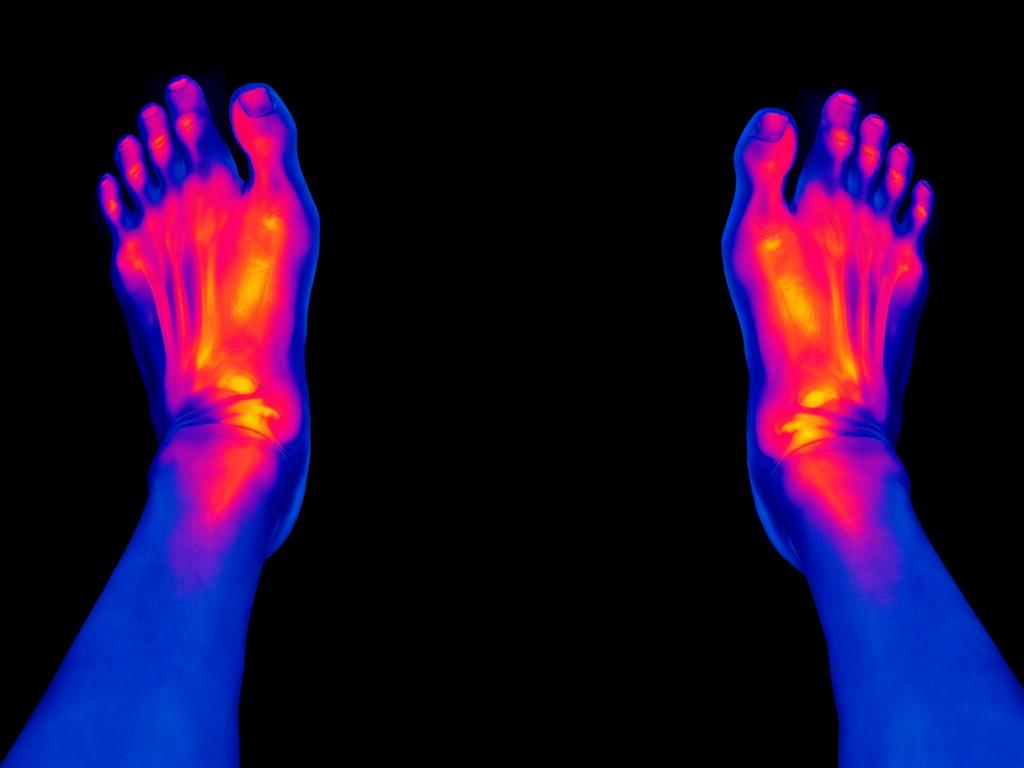 Thermographie des pieds montrant la circulation activée par LymphoBlast